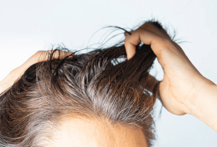 40代が抱える髪の毛の悩み