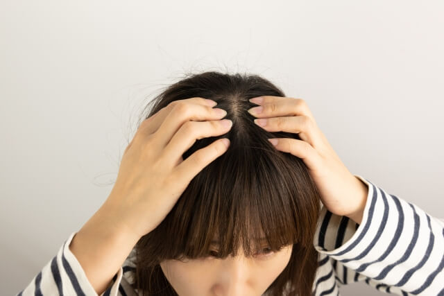 40代から女性の抜け毛の悩みが増える