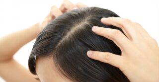 頭皮の乾燥に大きいフケ…今すぐ見直すべきシャンプー習慣